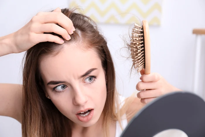 Problémy s vlasy je těžké skrýt, ale lze je snadno opravit. / foto: Shutterstock